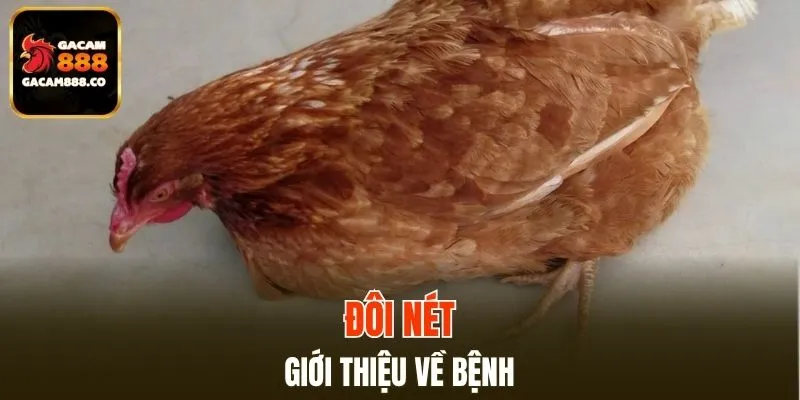 Khái quát thông tin về bệnh